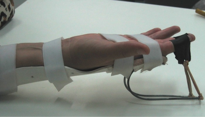 5.-Fizioterapiya-pri-artroze