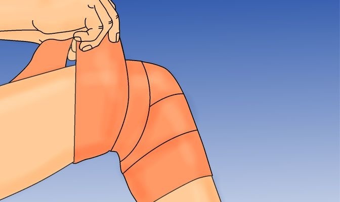 672px-Treat-a-Swollen-Knee-Step-5-Version-2