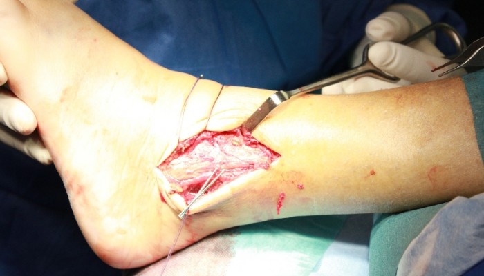 7.-Hirurgicheskoe-vmeshatelstvo