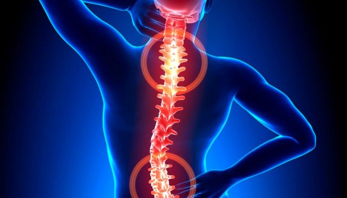 Osteohondroz-i-ego-zabolevanija