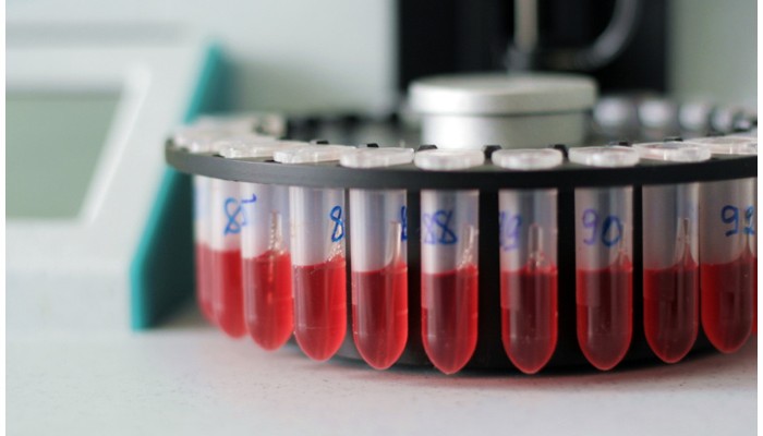 test of blood