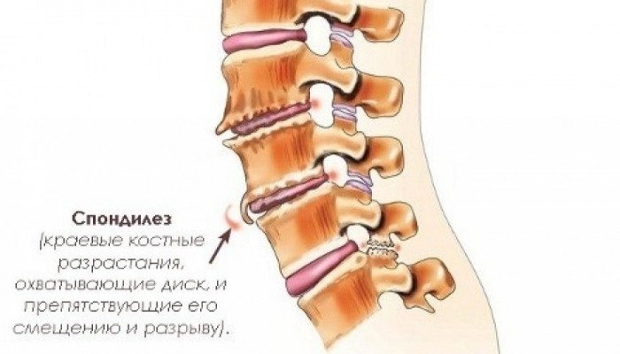 diabetikam_braslet_s_turmalinom_15_100