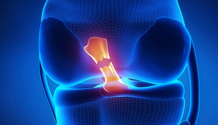 perednyaya-krestoobraznaya-svyazka