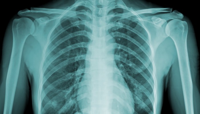 shutterstock_186267737