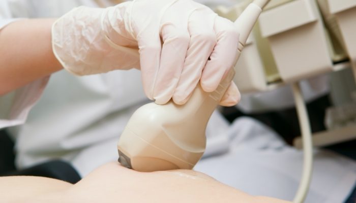 zapis-na-priem-k-vrachu-ijevsk-kardiologiya-34332-small