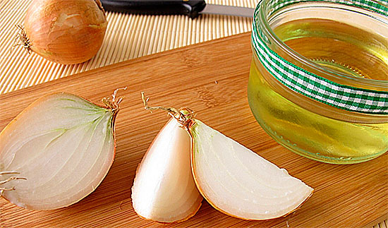 Луковая жизнь